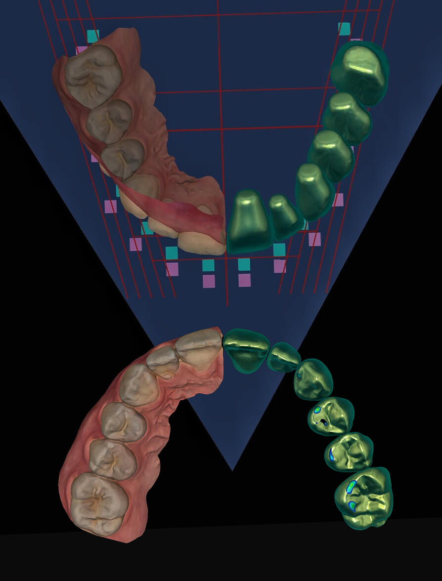 Full Mouth Restoration Mini-Residency CE Course Card