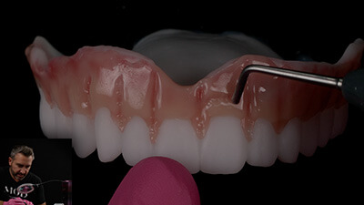 Monolithic denture icon