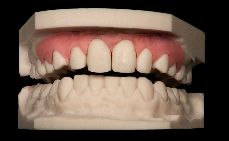 Tooth-Model