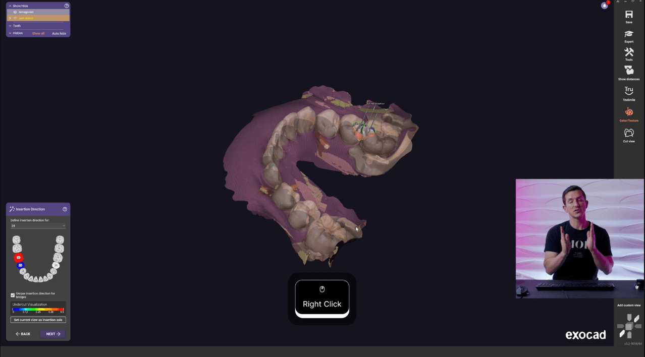 exocad level 7