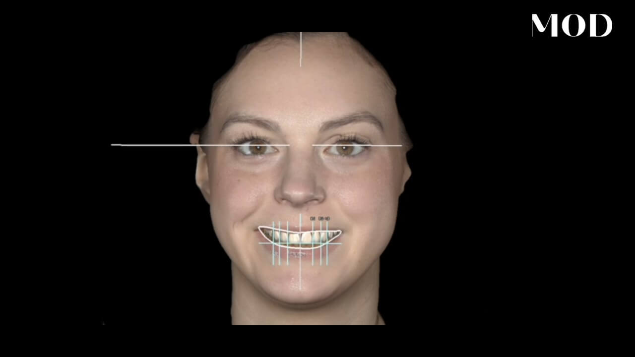 AI Smile Design