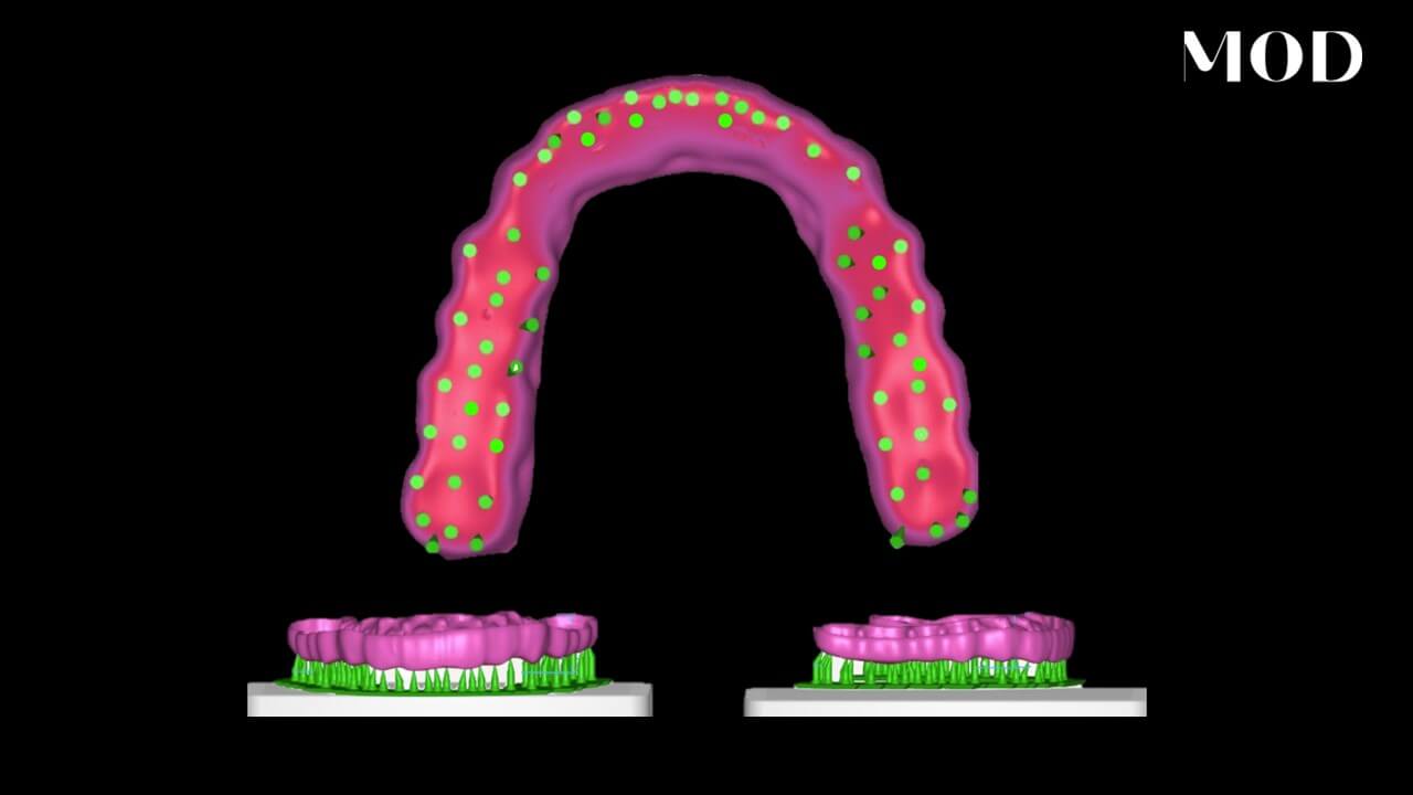 Nesting Occlusal Guards