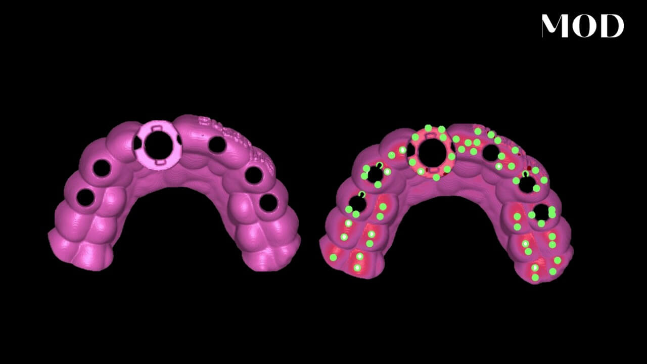 Nesting Surgical Guides
