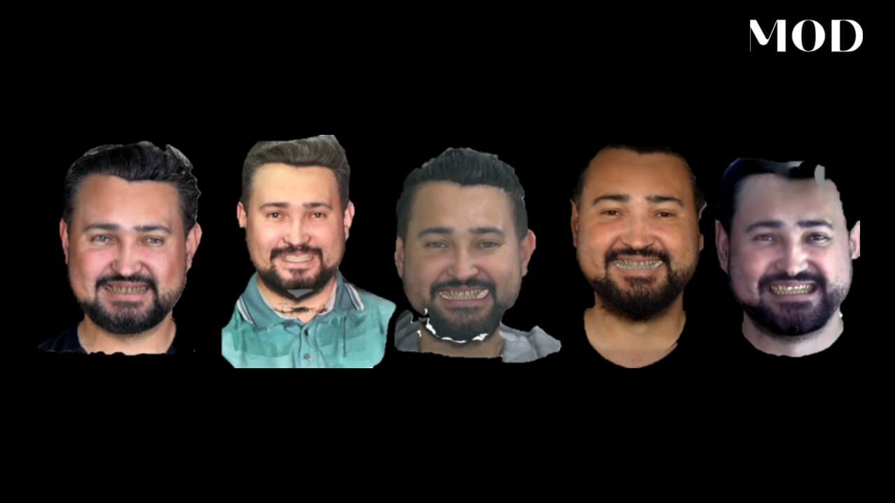 Qlone FaceScan